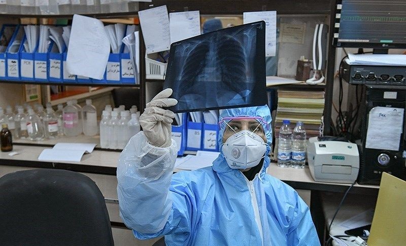 140 новых случаев коронавируса выявили в Якутии за сутки