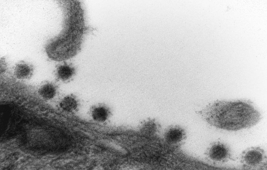 Центр «Вектор» впервые опубликовал фото дельта-штамма COVID-19