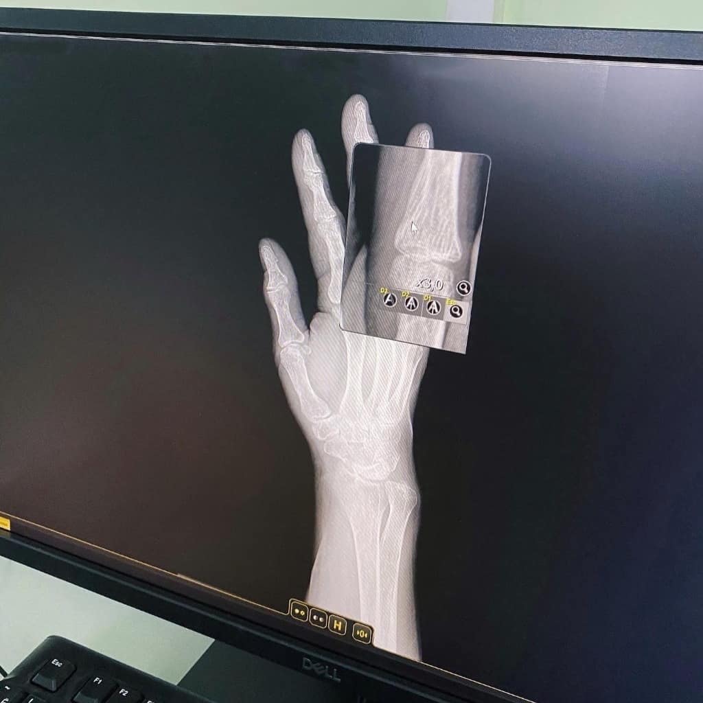 Новый рентгено-диагностический аппарат поступил в Мирнинскую ЦРБ в Якутии