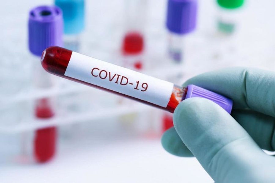 Ревакцинацию от коронавируса прошли 189 698 человек в Якутии