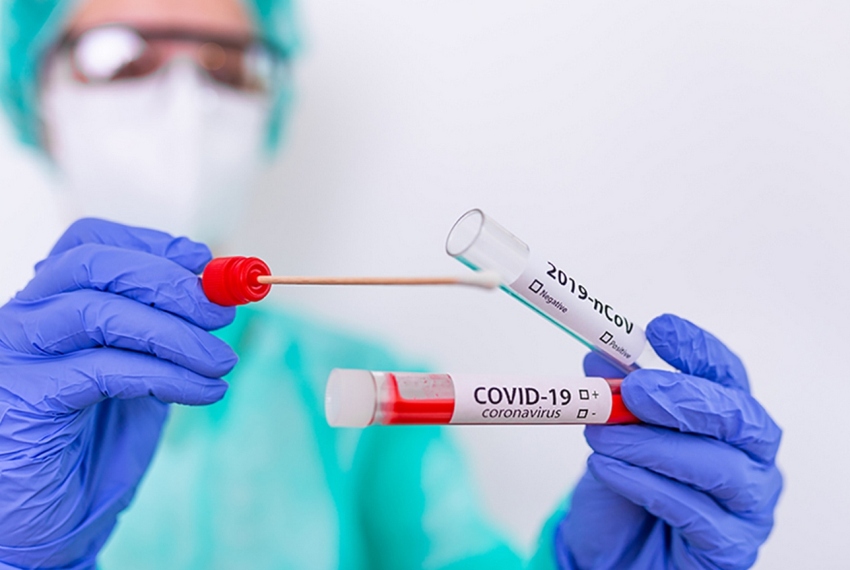39 новых случаев заболевания COVID-19 зарегистрировано в Якутии
