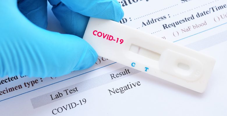 77 новых случаев коронавируса обнаружили в Якутии за сутки