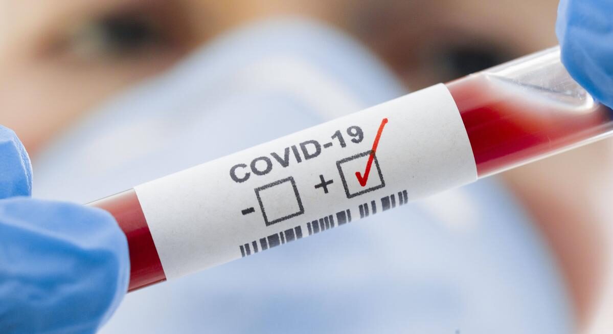 52 новых случая COVID-19 выявили в Якутии за сутки
